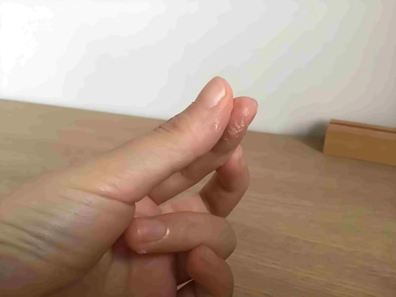 How to Safely Remove Super Glue from Skin？